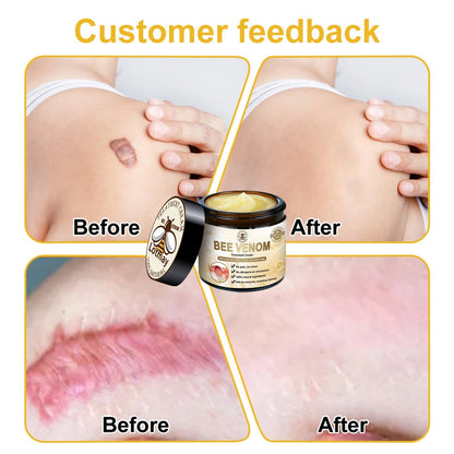 Lotmay™ Bee Venom Skin Treatment Cream（👨‍⚕️AAD Recommended）