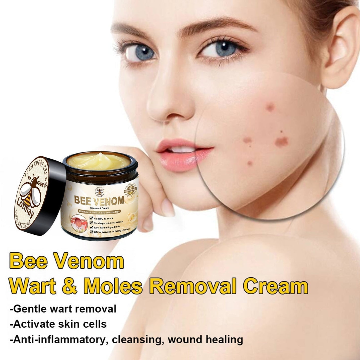 Lotmay™ Bee Venom Skin Treatment Cream（👨‍⚕️AAD Recommended）